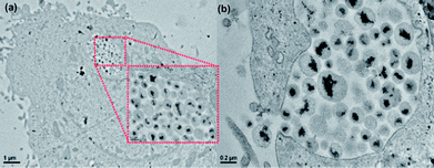 
            TEM images of KB cells incubated with the PNIPAM beads after 24 h at 37 °C. Low magnification image showing the PNIPAM–NBs up-taken by the cell and accumulated in the endosome (see the inset). (b) Invagination of the cell membrane and formation of the endosome containing the PNIPAM–NBs.