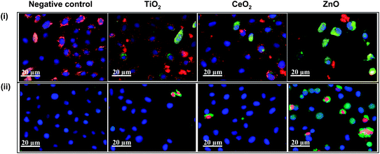 High content screening for assaying cytotoxic events triggered by nanoparticle interaction. (i) BEAS-2B cells subjected to nanoparticles, stained with nucleic acid staining Hoechst 33342 and mitochondrial dye JC1. Healthy cells show blue nuclei and red mitochondria (negative control, TiO2 and CeO2) while the mitochondrial depolarization causes the cytoplasm to fluoresce green (green cells in ZnO). (ii) BEAS-2B cells treated with nanoparticles and stained with a dye cocktail of Hoechst 33342, fluo-4 (for intracellular Ca2+) and propidium iodide (for accessing membrane damage). Healthy cells show blue nuclei, while damaged cells show green cytoplasm and red nuclei (cells in ZnO group). Depending upon the color profile, the percentage of cells affected can be assayed and nanoparticles can be ranked for their cytotoxic potential. Figure reproduced from ref. 116 with permission.