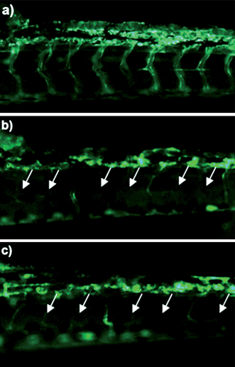 Antiangiogenesis effect of Cur/MPEG-PCL micelles on a zebrafish model. Zebrafish embryos were treated with Holtfreter's solution (control), free curcumin (5 μg mL−1) or Cur/MPEG-PCL micelles (5 μg mL−1) for 72 h. Blood vessels were examined using a fluorescence microscope. The control embryo (a) shows a regular spacing of intersegmental vessels. Embryos treated with curcumin (b) or Cur/MPEG-PCL micelles (c) showed defective vascular formation in varying extents of severity: either they sprouted abnormally or failed to form (arrows).