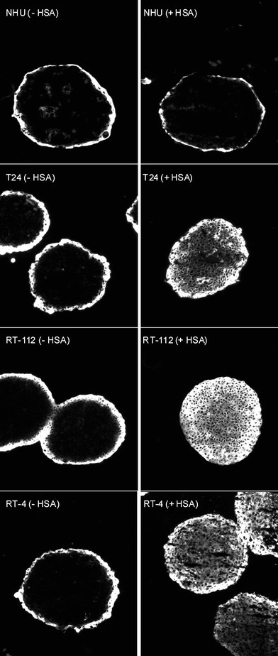 Fluorescence photomicrographs of 5 μm centrally cut sections of NHU and UCC (T24, RT-112 and RT-4) spheroids incubated with 10 μM hypericin in the presence or absence of HSA (0.3% [m/v]). Single representative experiments; other images were similar. All photomicrographs were taken at identical gain and were reduced from ×200.