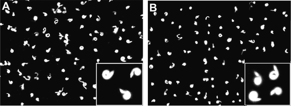 Photophobic behaviour of Blepharismacells to a sudden increase of light intensity. The pictures of control cells (A) and cells treated with RNAi (B) were taken by 3 s exposure under dark-field conditions.