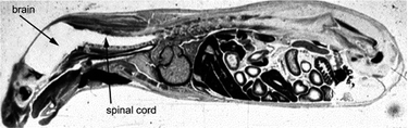 
          Autoradiogram of an adult mouse 30 min after intravenous injection of radiolabelled histamine. The dark regions show where the histamine is located—none is detected in the brain and spinal cord regions. Reprinted from W. M. Pardridge, The Blood–Brain Barrier: Bottleneck in Brain Drug Development, NeuroRx, 2005, 2, 3–14, Copyright (2005), with permission from The American Society for Experimental NeuroTherapeutics, Inc. Published by Elsevier Inc.