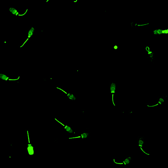 
            Confocal micrograph of boar spermatozoa after incubation with a poly[GalEMA-DMAEMA-hostasol methacrylate] terpolymer. Image provided by the author.