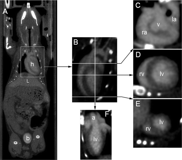 Images illustrating the contrast enhancement obtained 75 min after IV injection. (A) Whole body coronal view crossing heart (h), liver (L) and bladder (b), showing the dual elimination route. (B) Four cavity slice through the heart (obtained after reorientation), lines indicate positions of corresponding transverse slices (see below). (C) Transverse slice through the base of the heart: right atrium (ra), aortic valve plane (v), left atrium (la). (D) Transverse slice through the middle of the heart : right ventricle (rv) and left ventricle (lv). (E) Transverse slice through the apex of the heart. (F) Slice through the left ventricle showing the beginning of the aortic cross (a).