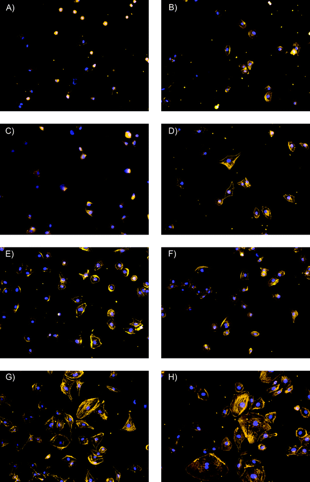 Fluorescent micrographs of human dermal microvessel endothelial cells after 3 h of adhesion on the selected substrates. Stains: Alexa Fluor 568® Phalloidin and 4′′,6-diamidino-2-phenylindole dilactate. Magnification: 20×. (A) Si/SiO2 substrate; (B) Unmodified substrate coated with PDMS-like film; (C) PDMS-like substrate modified with BSA under favorable conditions; (D) PDMS-like substrate modified with BSA under unfavorable conditions; (E) PDMS-like substrate modified with Fib under unfavorable conditions; (F) PDMS-like substrate modified with Col under unfavorable conditions; (G) PDMS-like substrate modified with Col under favorable conditions; (H) PDMS-like substrate modified with Fib under favorable conditions.