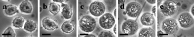 
          Microscope image (40×) magnification of U937 cells after exposure to SM-TNs. a) Untreated U937 cells. b) U937 cells treated with 200 nm, and 35 nm ODS empty shells. c) U937 cells treated with microcrystalline (free) Taxol prepared by sonicating Taxol in 20%H3PO4/0.8% SDS solution. d) U937 cells treated with 200 nm SM-TN. A SM-TN is seen in the middle of the picture. e) U937 cells treated with 35 nm SM-TN. The nanowires are too small to see at this magnification, but their effect on the cells is clearly visible. Scale bar = 10 μm.