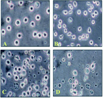 Cell viability assay for compound 3l. (A) 0 h. (B) After 3 h. (C) After 20 h. (D) After 24 h of treatment of U937 cells with compound 3l visualised under inverted microscope.