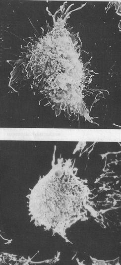 Reverse transformation of human gastric adenocarcinoma cell line MGc80-3 (upper) induced by 20 μmol l−1 verbascoside for 7 days, the abundant amounts of microvilli and microfilaments were reduced significantly (lower). Reproduced by permission of Georg Thieme Verlag KG Publishers.