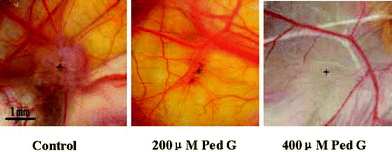 After pretreatment with pedicularioside G, low tumorigenicity and angiogenic activity of human hepatoma cells transplanted in chicken embryo chorioallantoic membranes is exhibited. + represents the centre of a tumor lump, which is a visible light colored disc, but the disc is very thin and small in the Ped G treated groups. Reproduced by permission of Wiley-Blackwell Publishing.