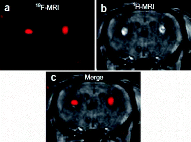The fluorinated probe FSB was introduced by stereotaxic injection into the bilateral basal ganglia of 6-month-old wild-type mice. (a) 3D RARE coronal 19F MR image, (b) T1-weighted gradient-echo coronal 1H MR image, (c) merged 19F and 1H MR images. Reprinted by permission from Macmillan Publishers Ltd: Nature Neuroscience (ref. 64), copyright 2005. Only relevant frames a, b and c have been extracted from the original figure.