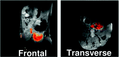 MR images of mouse abdominal region 2 h after tail vein injection of polymer with acid end groups (P1) into mouse. 1H image is shown in greyscale and 19F image is overlaid. P1 can be seen to accumulate in the bladder region. Reprinted with permission from ref. 43. Copyright 2010 American Chemical Society.