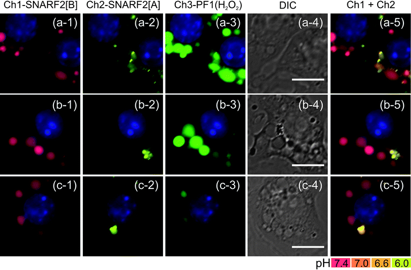 
            Fluorescence imaging of oxidative burst and pH change in early phagosome with G5-SNARF2-PF1-Ac (300 μg mL−1 in DMEM). Row (a) shows RAW 264.7 cells stimulated with PMA for 15 min. Generation of H2O2 in early phagosomes is displayed by the colocalization of SNARF2[B] with fluorescein, a product of the reaction of PF1 with H2O2. Row (b) displays PMA stimulated RAW 264.7 in the presence of superoxide dismutase (SOD 5,000 U mL−1). Row (c) shows PMA stimulated cells in the presence of SOD (5,000 U mL−1) and catalase (5,000 U mL−1). Column (1) Ch1 filter set (600: 670–710), (2) Ch2 filter set (550: 570–640), (3) Ch3 filter set (470: 500–550), (4) DIC image, scale bar = 10 μm, and (5) overlay image of Ch1 and Ch2, nuclear staining with Hoechst 33342.