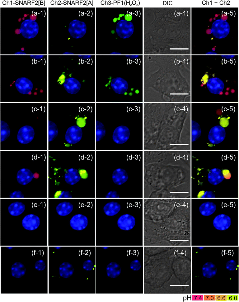 Inhibition of Nox activity in PMA-stimulated RAW 264.7 cells with various doses of DPI. (a) no DPI, (b) 200 nM, (c) 500 nM, (d) 1 μM, (e) 5 μM, and (f) unstimulated cells with no PMA and no DPI. Phagosomal H2O2 decreases in a dose-dependent manner with DPI. DPI treated cells also show faster acidification of phagosome. At 5 μM DPI, endocytic activity is disrupted, showing the absence of pinocytosis compared to the unstimulated cells. Column (1) Ch1 filter set (600: 670–710), (2) Ch2 filter set (550: 570–640), (3) Ch3 filter set (470: 500–550), (4) DIC image, scale bar = 10 μm, and (5) overlay image of Ch1 and Ch2, nuclear staining with Hoechst 33342.