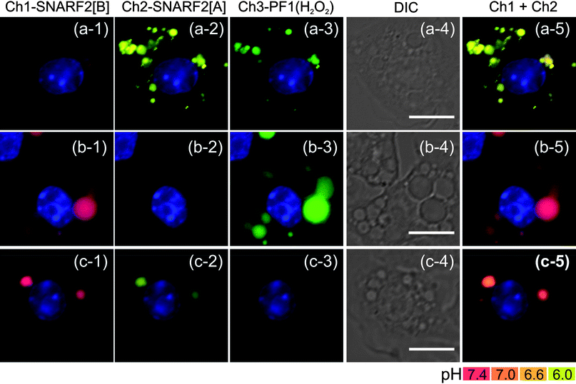 
            Fluorescence images of concanamycin A-treated macrophages that lead to the inhibition of the phagosomal acidification. RAW 264.7 cells were incubated with G5-SNARF2-PF1-Ac (300 μg mL−1 in DMEM), PMA (4 μg mL−1), with or without concanamycin A (400 nM) and DPI (500 nM). After 15 min, the labeling solution was removed. Cells were further incubated in label-free media for another 30 min before imaging. Row (a) shows PMA-stimulated RAW 264.7 cells 45 min after PMA stimulation. Overlay image of SNARF[A] and SNARF[B] shows marked acidic environment in phagosomal lumen. Row (b) displays concanamycin A-treated cells after 45 min PMA stimulation showing mostly neutral phagosome. Row (c) displays PMA stimulated cell treated with both PMA and DPI, in which mixed population of acidic and neutral pH phagosomes can be observed. Column (1) Ch1 filter set (600: 670–710), (2) Ch2 filter set (550: 570–640), (3) Ch3 filter set (470: 500–550), (4) DIC image, scale bar = 10 μm, and (5) overlay image of Ch1 and Ch2, nuclear staining with Hoechst 33342.