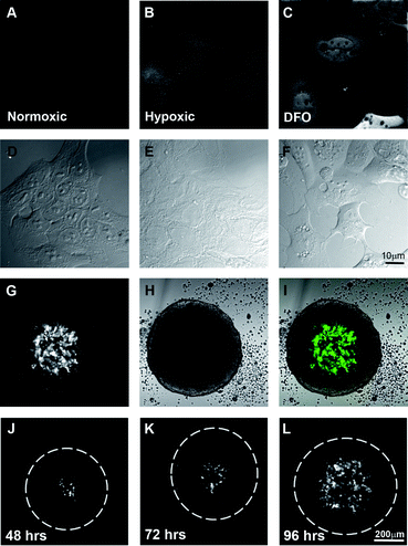 
            Hypoxia-dependent expression of EosFP in an artificially hypoxic environment as well as in the centre of spheroid cultures. Widefield fluorescent images of DLD-1 cells expressing HRE-EosFP grown in 2-dimensional culture in A. normoxia, B. hypoxia or C. normoxia plus desferroxamine with their respective DIC images D–F. Single confocal images indicating that HRE-EosFP is expressed in the central region of spheroids G–I. Time course of development of hypoxic areas in spheroids as shown by single confocal images of the centre of the spheroid at J. 48, K. 72 and L. 96 h. Scale bar 10 μm for A–F and 200 μm for G–L.