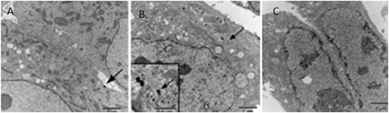 
            TEM images of cells incubated for 2 h with various AuNP conjugates. (A) KB cells with T–mPEG. (B) KB cells with T–PEG–F. (C) WI 38 cells with T–PEG–F. Reprinted with permission of the American Chemical Society (ref. 86, Thompson's and Andres' group).