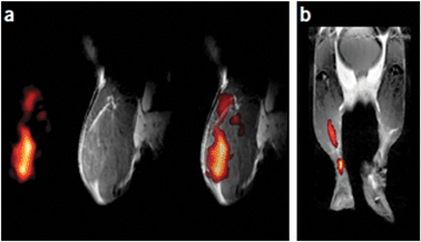 
          In vivo MRI of PFPE-labelled DCs in mouse (gray scale 1H, hot iron scale 19F). (a) Mouse quadriceps after injection of fluoro-labelled DCs: from left to right are 19F- and 1H-images and a merged19F/1H image. (b) Composite image of DC migration into the popliteal lymph node after injection of DCs into a hind foot pad. Reproduced from ref. 69, with permission. Copyright (2005) Nature Publishing Group's.