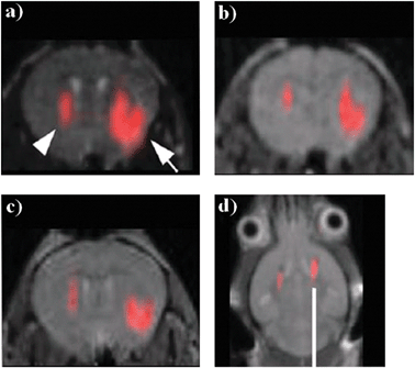 
          In vivo MR images of transplanted neural stem cells after (a) 1 hour, (b) 3 days and (c) 7 days after injection (19F signal superimposed on the 1H MR images; arrows indicate the left and right lobes where 4 × 104 and 3 × 105 labelled cells, respectively, were injected), (d) MR image after 2 weeks of injection on a different animal of 4 × 105 cells in both hemispheres. Adapted from ref. 70, with permission.