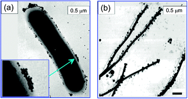 Gold nanoparticles in biomedical applications: recent advances and