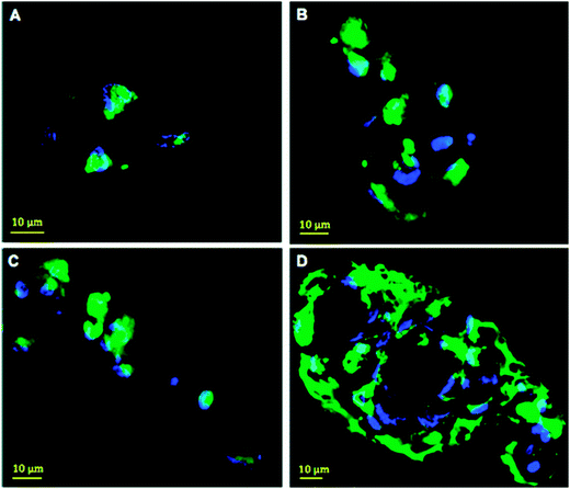 Injectable and biodegradable hydrogels: gelation Injectable and biodegradable hydrogels: gelation