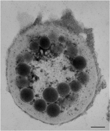 
              Transmission electron micrograph of a transverse section of the apical portion of a Leptolyngbyatrichome. The micrograph clearly shows osmiophilic globules that resemble the eyespot of eukaryotic algae. Scale bar: 0.15 μm.