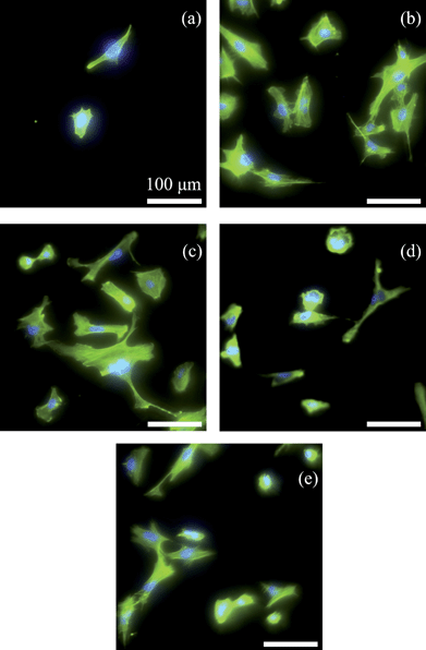 
            Fluorescence microscopy images showing osteoblast morphology on NCDH (a), NCDO (b), NCDN (c), Si (d) and borosilicate glass (e) after culturing for 12 h (bar = 100 μm). Osteoblasts were stained by rhodamine phalloidin and the nuclei were stained by DAPI.