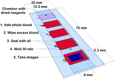 Illustration of the fluidic chip and its usage. Height (26.5 μm) and shape of the test chambers are defined by laminating adhesive between a standard size and half a microscope slide, leaving openings to let blood in and air out. One of the inner surfaces is coated with dried gelatine containing fluorochrome-conjugated antibodies for cell staining. The slide fills by capillary flow, is sealed with mineral oil and after 10–30 min incubation, fluorescence images are taken for cell counting. The inset represents a 0.4 mm × 0.27 mm section of the overlay of two 8 mm × 5.3 mm images after background subtraction.