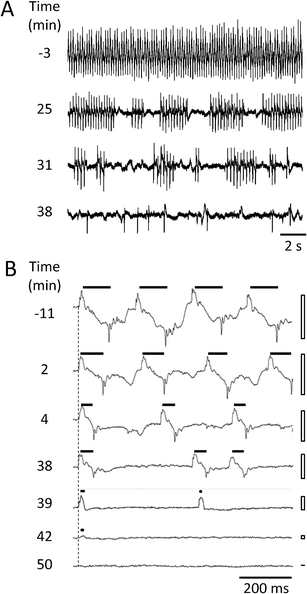 Changes in EPG waveform and frequency during ivermectin treatment. A and B each show representative recordings from a single wild type worm at the times indicated at left, relative to the switch from control solution to ivermectin (designated 0 min). Vertical gain (voltage) is the same for all traces within a panel. A. Changes in action potential timing and amplitude. This worm was tailfirst in the channel so E spikes are downward in the Figure. B. Changes in EPG waveform. This worm was headfirst in the channel and EPG traces are aligned (vertical dashed line) by the onset of a positive E spike, except for the bottom trace which occurred after EPG activity ended. The ivermectin concentration was 10 μM. Filled bars show E-to-R duration for each action potential waveform; filled circles indicate action potentials waveforms with an E but no R spike; open bars indicate voltage excursion of EPG waveforms in the adjoining trace.