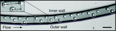 Double equilibrium position of the HL60 cells observed in the focal plane, in the second loop of the curved microchannel. Insert shows the longitudinal distance measurement, L1, of the cells at the single equilibrium position at the inner wall and L2 for the longitudinal distance of the cells in the alternating pattern. Scale bar is 50 μm.