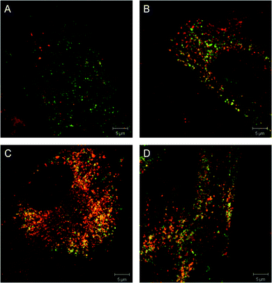 
          Translocation studies of N370S GCase in Gaucher fibroblasts (genotype N370S N−1370S). Gaucher fibroblasts were stained for LAMP-1 (green) and GCase (red) in the presence of (A) DMSO (vehicle), (B) 1 μM Isofagomine, (C) 1 μM of compound 24, (D) 1 μM of compound ML156 (8i). Scale bar is 5 μm.