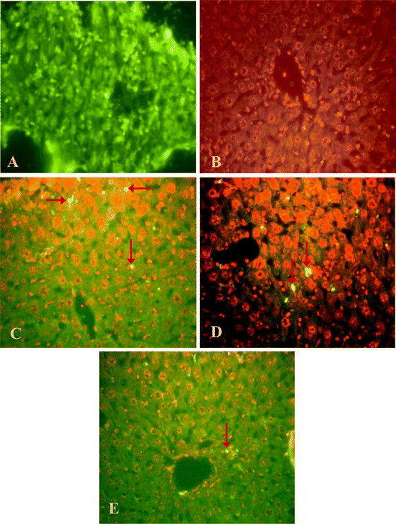 
            In situ detection of fragmented DNA [deoxyribonucleotidyl transferase-mediated dUTP-FITC nick-end labeling (TUNEL) assay] in the liver of mice, 40×. (A) Positive control (DNA damage was induced in the liver section by the application of HCl) showing TUNEL positive cells with yellowish green fluorescence. (B) Control (without any exposure) mice liver sections not showing any yellowish green fluorescence. (C) and (D) Arsenic and fluoride exposed mice liver sections showing yellowish green TUNEL positive cells (arrows). (E) Arsenic and fluoride coexposed mice liver sections showing yellowish green TUNEL positive cells (arrow). Note decrease in the intensity of fluorescence in E as compared to C and D.