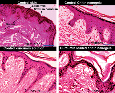 Images showing results of histopathology studies for control curcumin solution, control chitin nanogels and CCNGs.