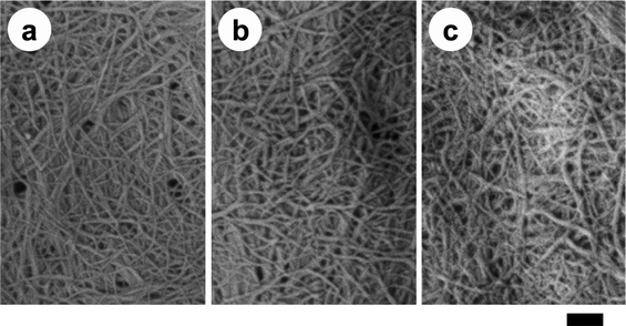 SEM images of acetylated chitin nanofiber samples of (a) DS 0.99, (b) DS 1.81, and (c) DS 2.96. The length of the scale bar is 200 nm. Reprinted with permission from ref. 56. Copyright 2010, American Chemical Society.