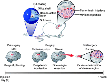 Triple-modality MRI–photoacoustic–Raman imaging strategy for entire brain tumor surgery.117