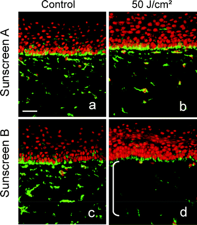 Protection of dermal fibroblasts by sunscreen A (SPF 7.5 and UVA-PF 7) and B (SPF 7.5 and UVA-PF 3) (see Fig. 1) using vimentin immunostaining made 48 h after UV-DL esposure (0 or 50 J cm−2) on reconstructed skin where product A (a, b) or product B (c, d) was applied before exposure.45