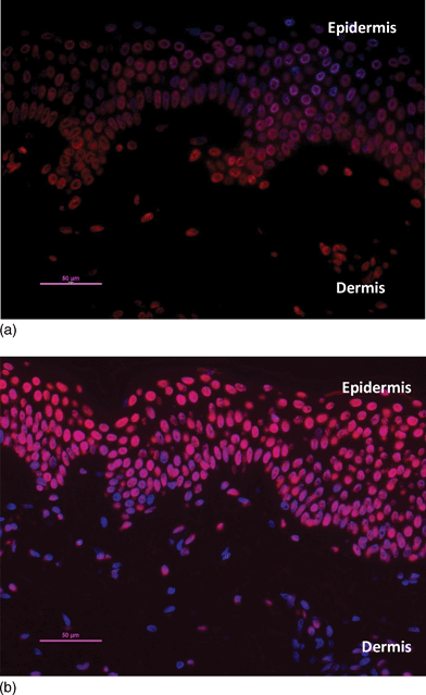 Staining of dermal nuclei for T<>T, 3 notional MED (a) UVA1 (b) UVB. The red stain is indicative of T<>T. Biopsies were taken immediately after exposure. See Tewari et al.24 for quantification of epidermal data that allows comparisons with Fig. 4, 5 and 6.