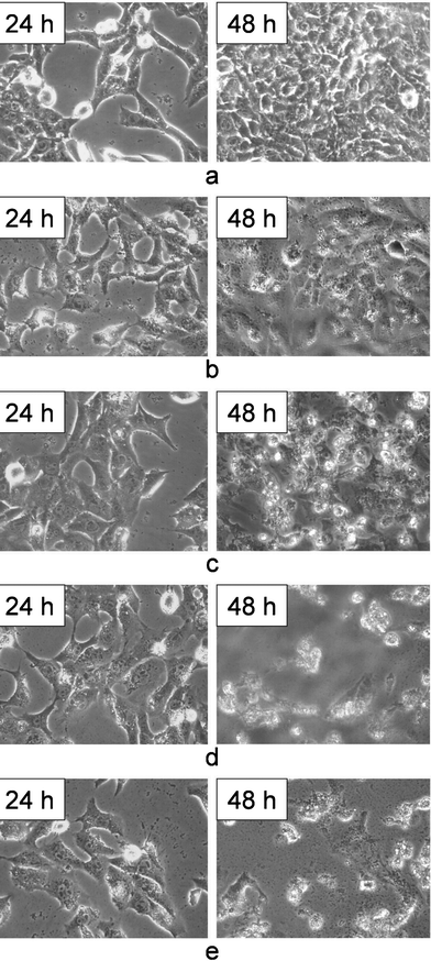 Morphology of HeLa cells observed by an inverted microscope after being treated by different agents for 24 h and 48 h. (a) control, (b) CaCO3/DNA, (c) free DOX, (d) CaCO3/DNA and free DOX (e) CaCO3/DNA/DOX. The images were obtained under magnification of 200.