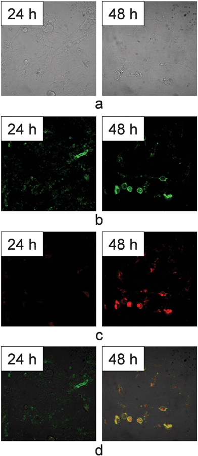 Confocal images of HeLa cells after being treated by CaCO3/DNA/DOX for 24 h and 48 h. (a) DIC images, (b) green fluorescence images (c) red fluorescence images, and (d) overlapped images of red and green fluorescence. The images were obtained under magnification of 400.