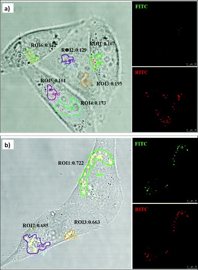 Ratiometric imaging of pH in various intracellular compartments using confocal microscopy. HeLa cells were incubated at 37 °C with MSN-PP and MSN-TA for 4 h, respectively. The images (overlaid on bright field) of pH sensors in HeLa cells showing (a) MSN-PP, and (b) MSN-TA.