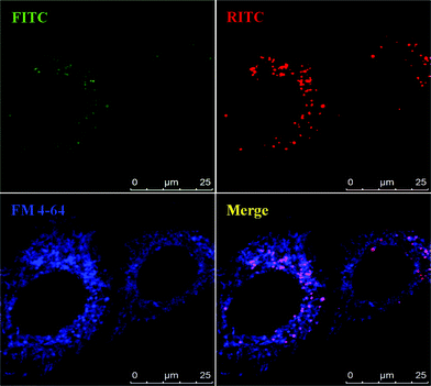 
          Confocal microscopy analysis of MSN-PP in HeLa cells. The living unfixed cells were co-treated with endosome-specific marker FM 4–64 (5 μg ml−1) and analyzed by confocal microscopy for an endosomal colocalization image. The fluorescent images show the MSNs (green, FITC and red, RITC) and FM 4-64-labeled endosomes (blue).