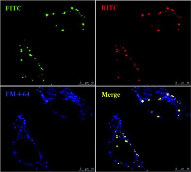 
          Confocal microscopy analysis of MSN-TA in HeLa Cells. The living unfixed cells were co-treated with endosome-specific marker FM 4–64 (5 μg ml−1) and analyzed by confocal microscopy for an endosomal co-localization image. The fluorescent images show the MSNs (green, FITC and red, RITC) and FM 4-64-labeled endosomes (blue).