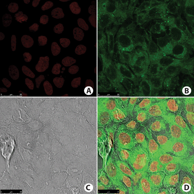 
            MCF-7 cancer cells. (A) Cell nucleus stained with TO-PRO-3 (red). (B) Fluorescence signal from cell incubated with BTD–H (green). Note that no nucleus was stained. (C) Phase contrast image of the cells. (D) Overlay of all fluorescence signals plus phase contrast image of the cells.