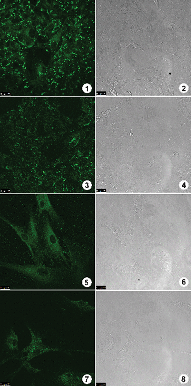 Staining assays using BTD–Br and BTD–H with cancer cells Caco-2 and normal fibroblasts cells. Fluorescent signal can be observed on the left column and cell image by phase contrast on the right column. (1) and (3) show the fluorescence profile obtained on Caco-2 cancer cells stained by BTD–Br and BTD–H respectively. (5) and (7) show the fluorescence profile on normal fibroblast cells stained by BTD–Br and BTD–H respectively. (2), (4), (6) and (8) show cells morphology by phase contrast microscopy.