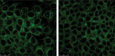 
            MCF-7 cancer cell mitochondria selectively stained with BTD–Br (left) and BTD–H (right).