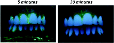 Photograph of the fluorescein-labelled nanoparticulate paste on the tooth surface, 5 and 30 min after application. The green fluorescence indicates adsorbed nanoparticles. The paste was predominantly located at the cervical and proximal tooth surface. After 30 min it was still visible.