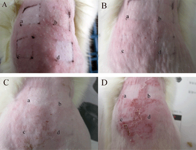 The skin states of erythema and ambustion after UV irradiation for 5 h and then studied after 0 (A), 1 (B), 2 (C) and 3 days (D): a: avobenzone-liposome; b: CDBA-liposome; c: PC-liposome (PC+Chol); d: avobenzone.