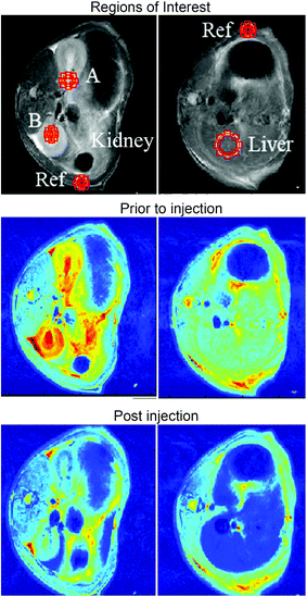 False colour T2 weighted MR images of the kidney (left column) and liver (right column) prior to, and after, intravenous injection of 1 mL of 8 nm HMNs with a relaxivity of ca. 80 mM−1 s−1 in phosphate buffer (left and right, respectively). The injected solution was at a concentration of 0.7 mM wrt Fe, 38 mM wrt phytantriol and 0.7 mM wrt F-127.