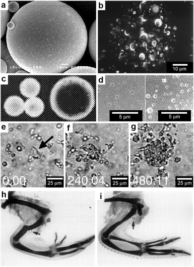 Chemical patterning with polymer microspheres. (a) Surface scanning electron (SEM) micrograph of a polymer microsphere. (Reprinted with permission from ref. 83. Copyright (2000) by Elsevier). (b) Three-dimensional confocal microscopy image depicting the spherical-occlusion structure of a single PLGA microsphere and localization of (fluorescently labeled) drug along the periphery of the occlusions. (Reprinted with permission from ref. 80. Copyright (1997) by John Wiley and Sons). (c) Laser scanning confocal microscopy cross-sections through the midline of 20 μm and 40 μm rhodamine-loaded microspheres, revealing increasing surface distribution of rhodamine as microsphere diameter increases. (Reprinted with permission from ref. 81. Copyright (2003) by Springer). (d) Surface scanning electronic micrographs of microspheres prepared at 38 °C and 4 °C respectively. (Reprinted with permission from ref. 83. Copyright (2000) by Elsevier). (e–g) Three frames from a time-lapse imaging experiment showing chemotaxis of dendritic cells into direct contact with one isolated large PLGA microsphere (denoted in the first frame by black arrow) filled with a chemoattractant. Elapsed times (min:s) are shown in the lower left of each frame. (Reprinted with permission from ref. 82. Copyright (2005) by Elsevier). (h,i) Chick wings that developed following the application of a range of doses (0.5 μg ml−1 for (h) and 0.1 mg ml−1 for (i)) of all-trans-retinoic acid from AGl-X2 beads (beads are indicated by arrows). Wing digit patterns vary depending on the concentration of all-trans-retinoic acid. (Reprinted with permission from ref. 84. Copyright (1985) by Academic Press).