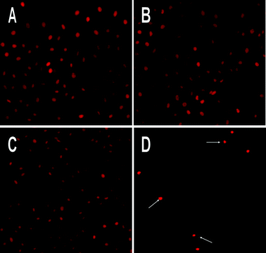PI stained fluorescence microscopy of apoptotic nuclei in HK-NPs-treated SKOV3 cells. Cells were treated with RPMI-1640 (A), PECE copolymer (B), F127 (C) and HK-NPs (D) at 12.5 μg mL−1 for 48 h. HK-NPs induced the morphological changes characterized as apoptosis: a brightly red-fluorescent condensed intact or fragmented nuclei, apoptotic bodies and a reduction of cell volume. Original magnification ×200.
