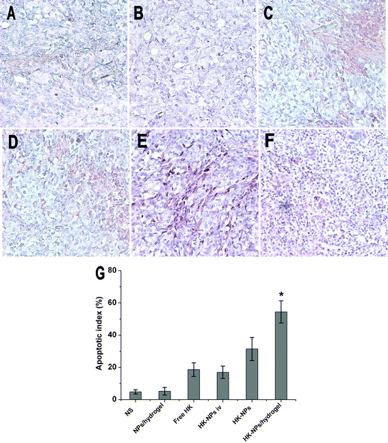 TUNEL staining of tumor tissues from each group. Representative sections were taken from tumor tissue of NS (A), blank NPs/hydrogel (B), free HK (C), HK-NPs iv (D), HK-NPs (E), and HK-NPs/hydrogel (F) treated groups, respectively. The percentage of apoptotic cells in HK-NPs treatment groups markedly increased compared with controls (P < 0.05), with an even greater induction of apoptosis in the HK-NPs/hydrogel-treated group (G).